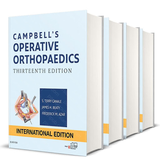 Campbell's Operative Orthopaedics, 4-Volume Set 13th Edition